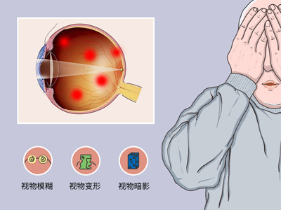 眼底角膜病治疗